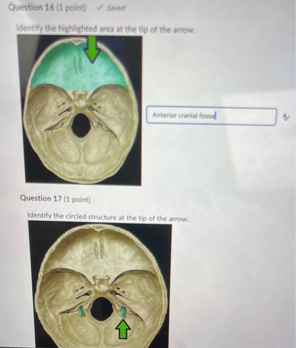 Solved Question 15 (1 point) Identify the highlighted | Chegg.com