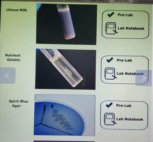 Solved 13. Describe your observations of the SIM test: B TVE | Chegg.com