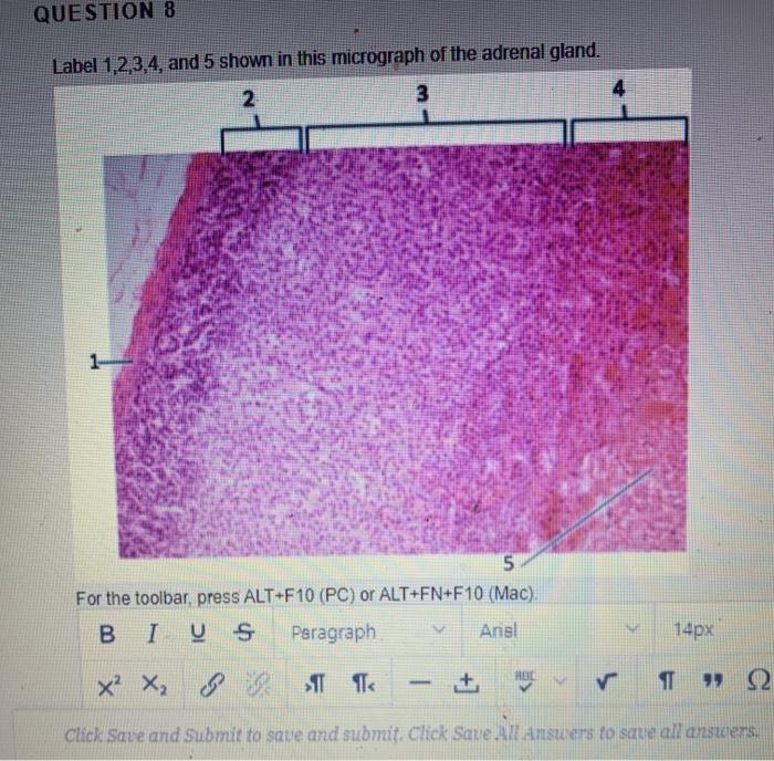 Solved Question 8 Label 1 2 3 4 And 5 Shown In This Micr Chegg Com