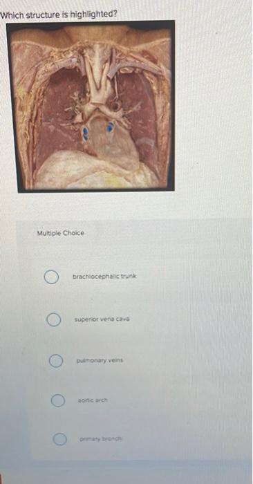 Which structure is highlighted?
Multiple Choice
brachiocephalic trunk
superior vena cava
pulmonary veins
aortic arch
primary 