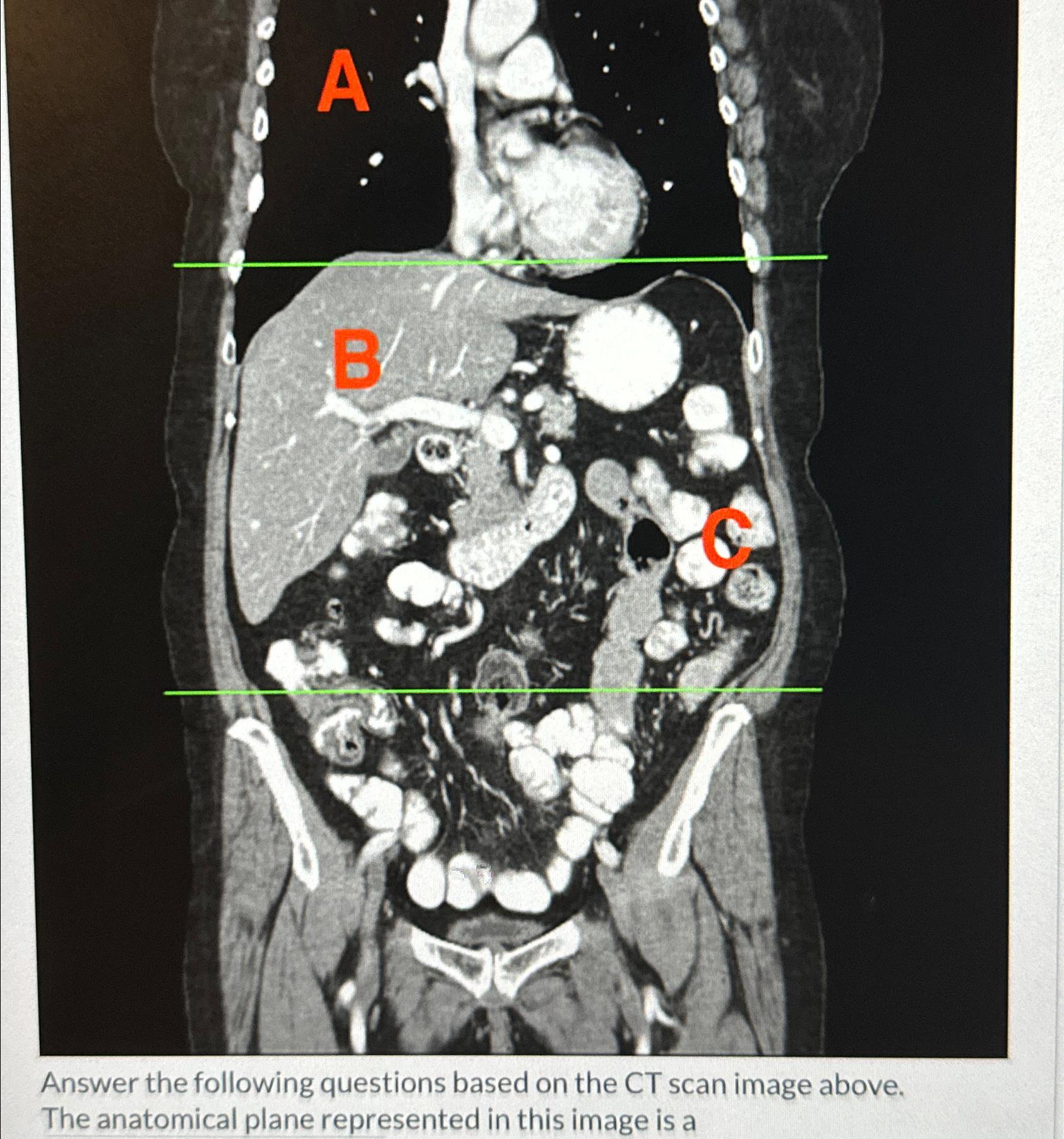 Solved Answer the following questions based on the CT scan Biology Diagrams