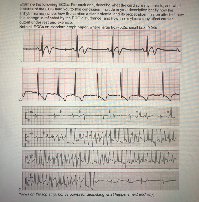 Solved Examine the following ECGs. For each one, describe | Chegg.com