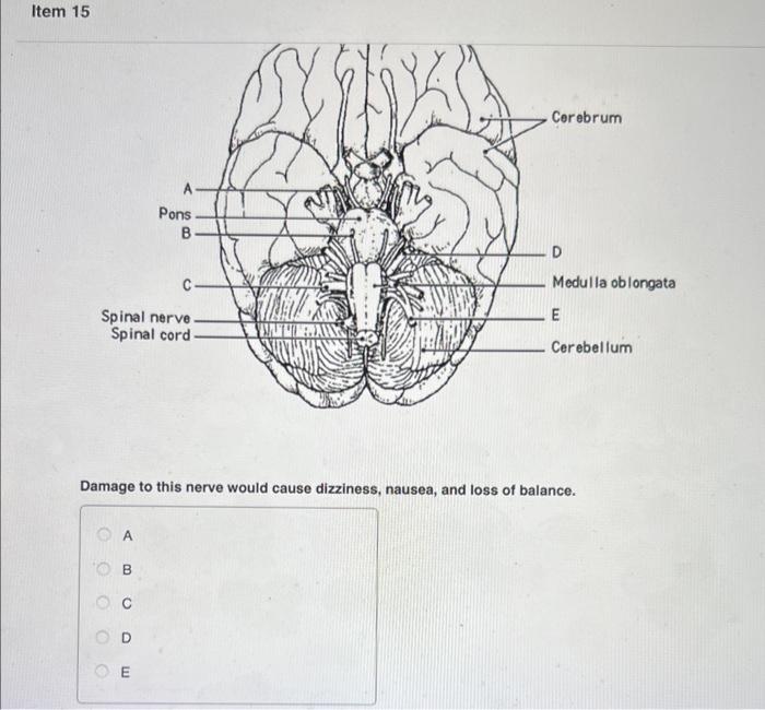 solved-damage-to-this-nerve-would-keep-the-eye-from-rotating-chegg