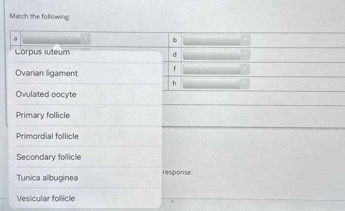 Solved Match the following: Match the following: | Chegg.com