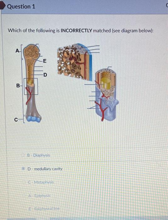 Which Of The Following Is Incorrectly Matched