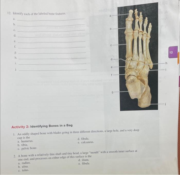 Solved 8. Identify each of the bones in the accompanying | Chegg.com