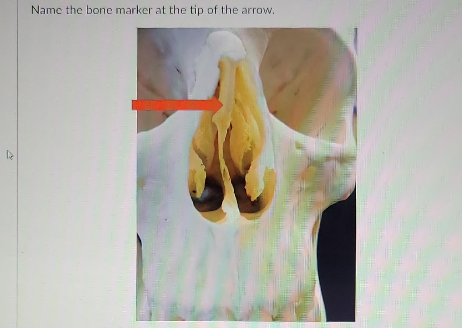 Solved Name the bone marker at the tip of the arrow. Name | Chegg.com