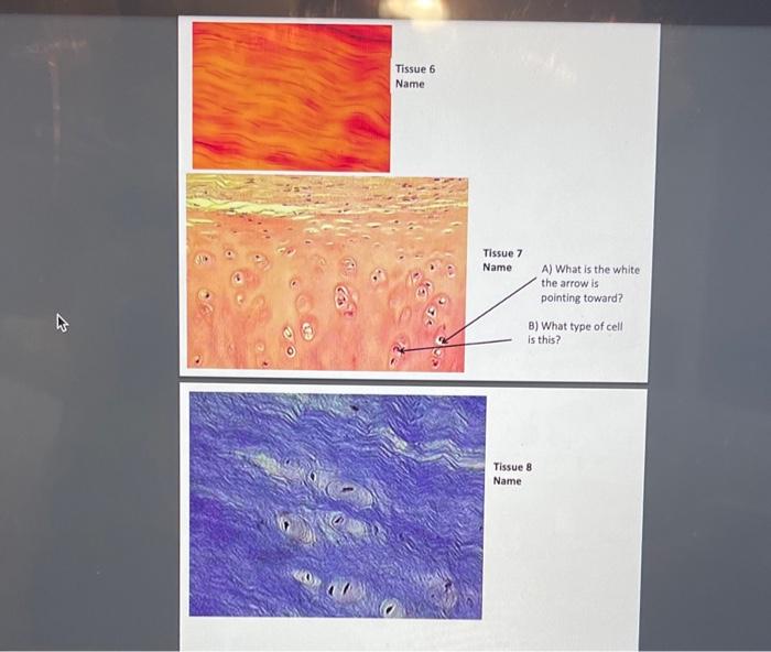 Solved Tissue 6 Name Tissue 8 Name | Chegg.com