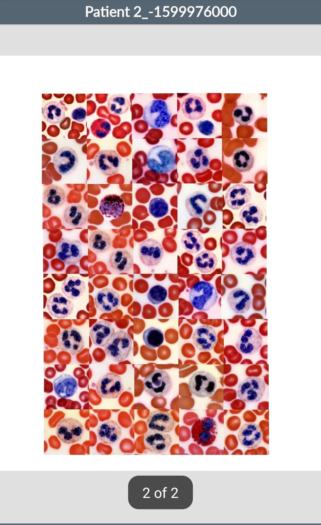 Solved Differential White Blood Cell Count You will be