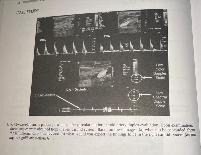 Solved I. A72 yurold female patient presents to the vascular | Chegg.com