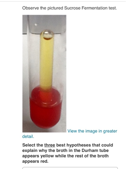 Solved Observe The Pictured Sucrose Fermentation Test View