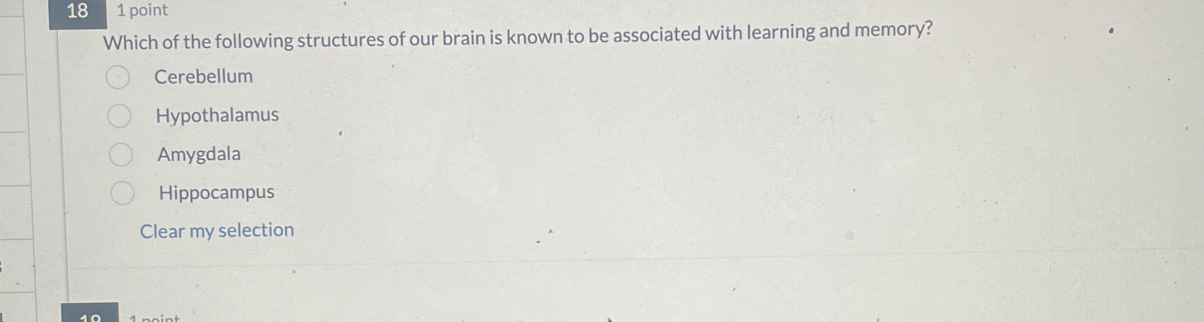 Solved Which of the following structures of our brain is | Chegg.com
