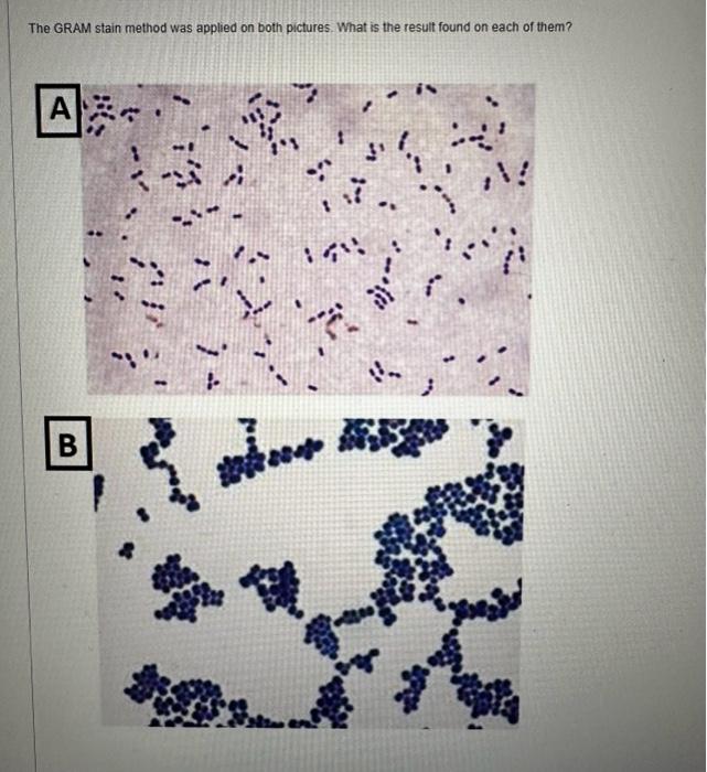 Solved The GRAM stain method was applied on both pictures. | Chegg.com