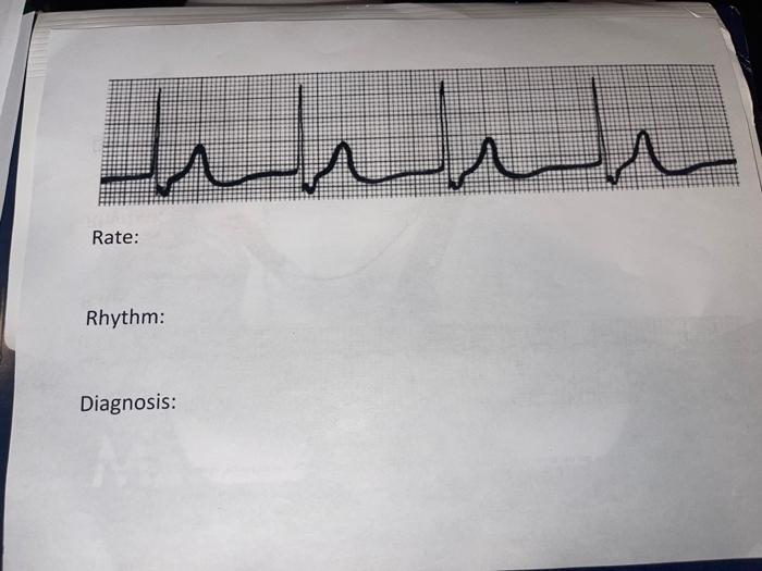 Solved Rate: Rhythm: Diagnosis: Rate: Rhythm: Diagnosis: | Chegg.com