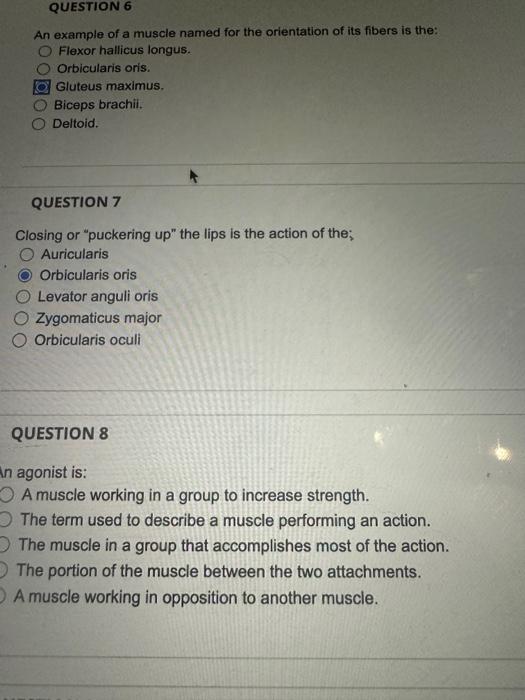 Solved QUESTION 6 An example of a muscle named for the Chegg