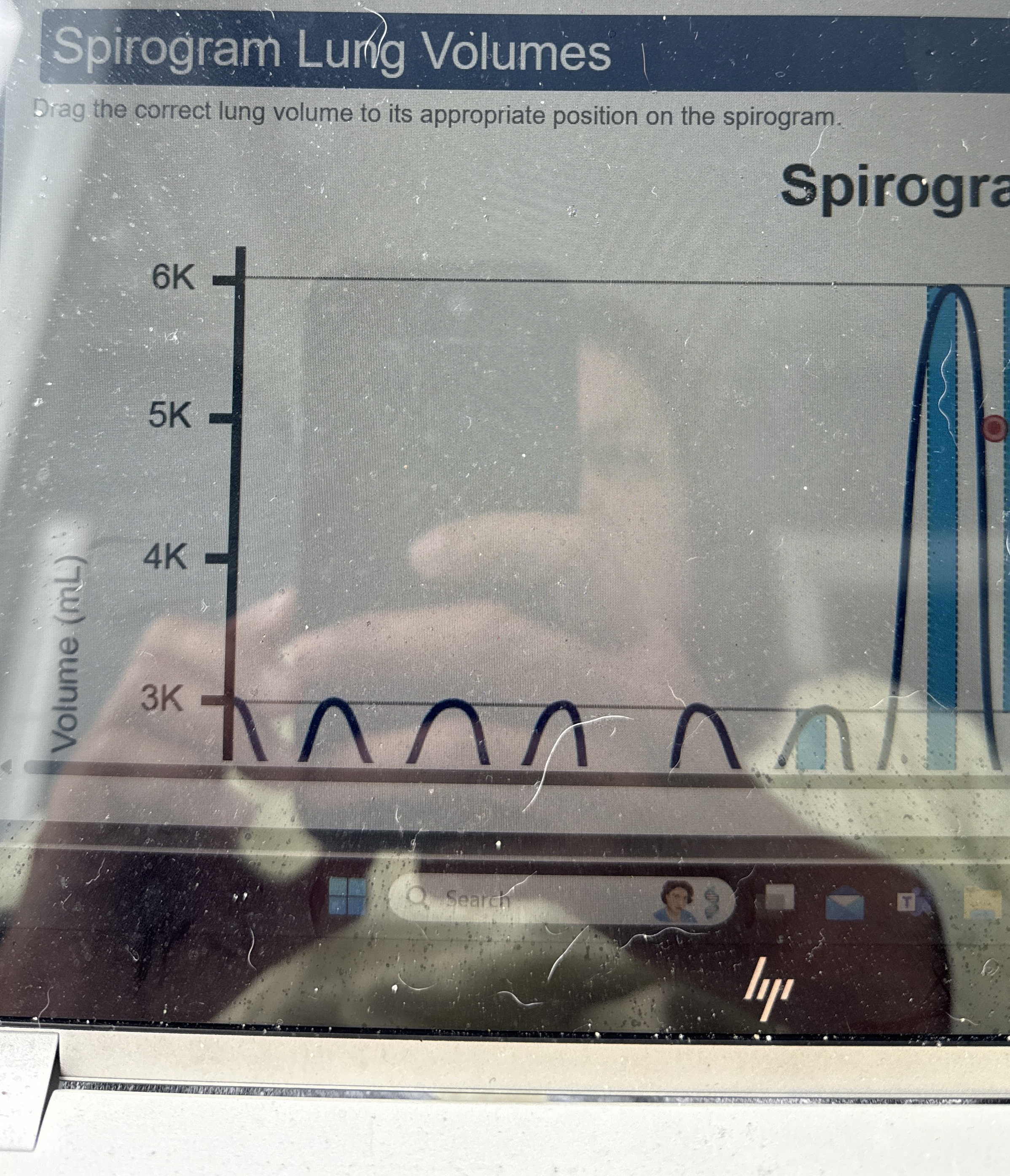 Spirogram Lurng VolumesDrag the correct lung volume | Chegg.com
