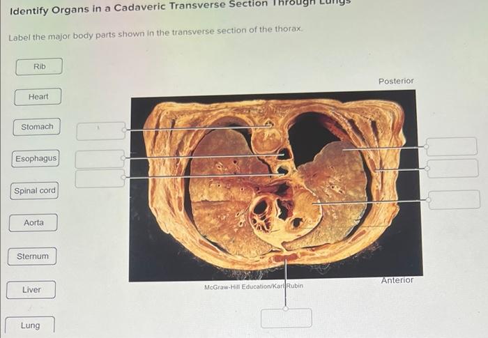 Solved Identify Organs in a Cadaveric Transverse Section | Chegg.com