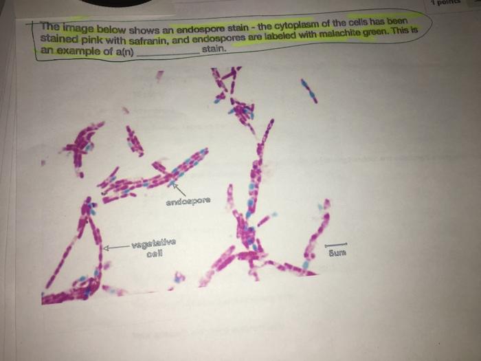 Solved The image below shows an endospore stain the