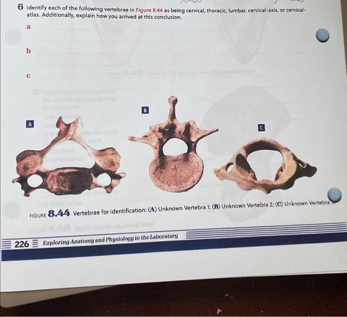 Solved 6 Identify each of the following vertebrae in Figure | Chegg.com
