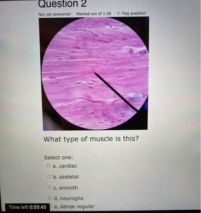 Solved Question 2 Not Yet Answered Marked Out Of 1 00 P F Chegg Com