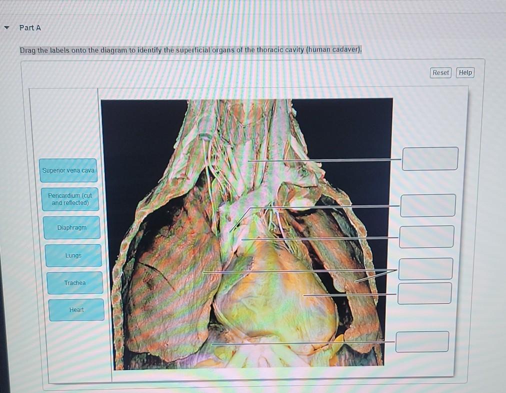 superior vena cava cadaver heart