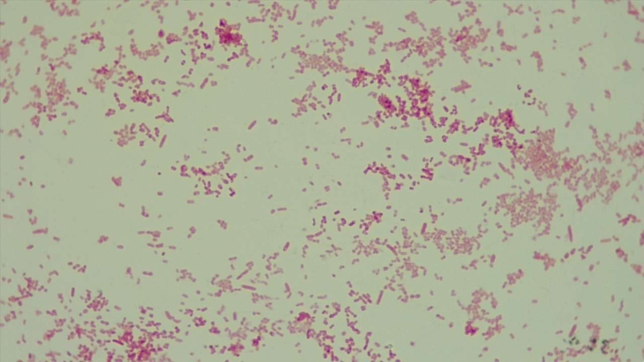 Solved Gram Stain: -Unknown #5B Is the image Gram- ﻿negative | Chegg.com