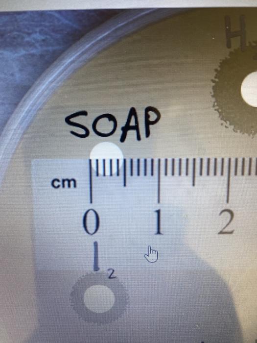 Solved measure the diameter of the zone of inhibition in