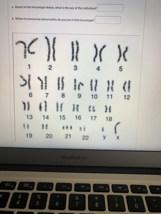 Solved A Based On The Karyotype Below What Is The Sex Of