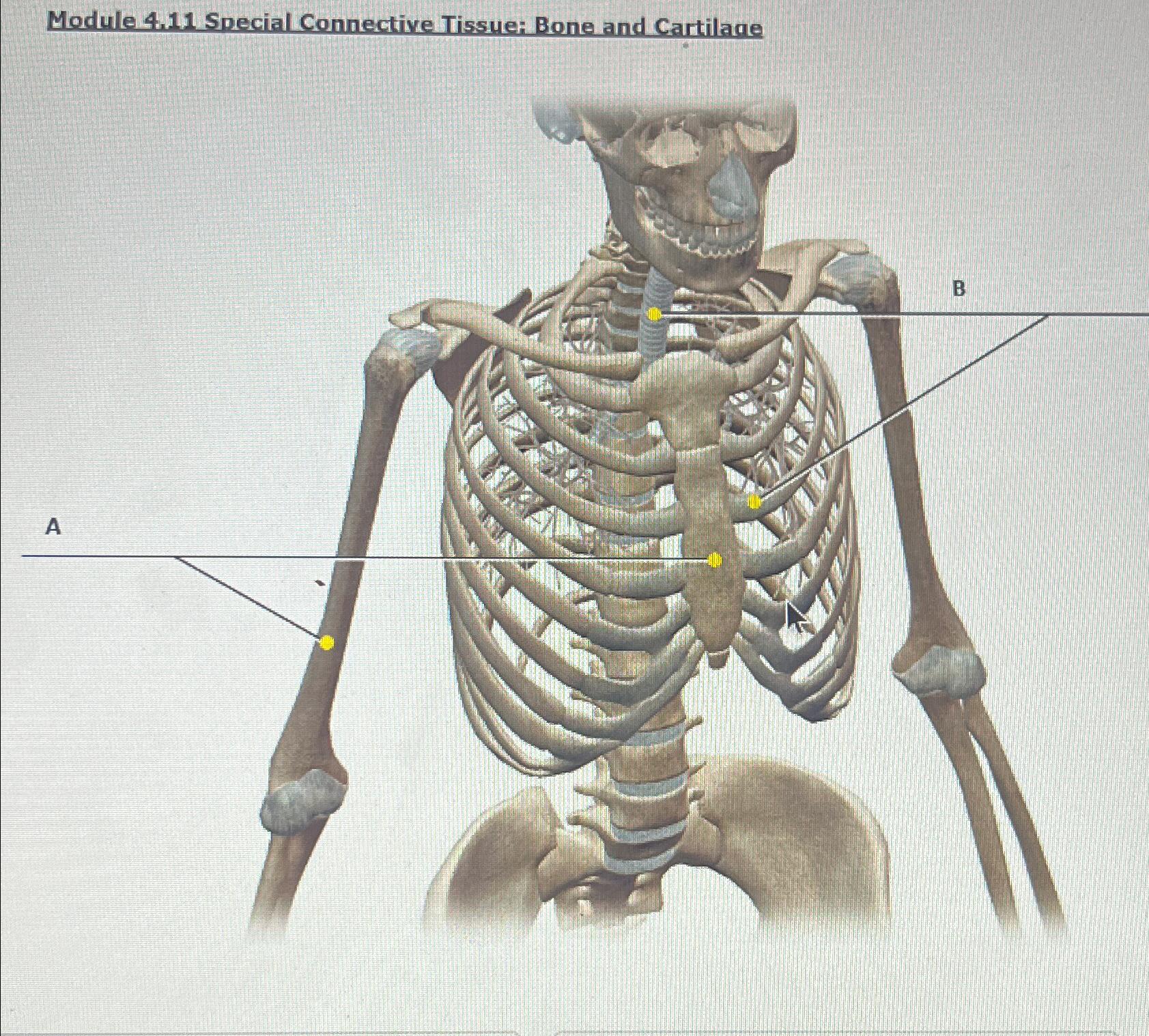 Solved Module 4.11 ﻿Special Connective Tissue: Bone and | Chegg.com