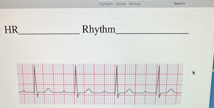 Solved HR RhythmHR Rhythm | Chegg.com