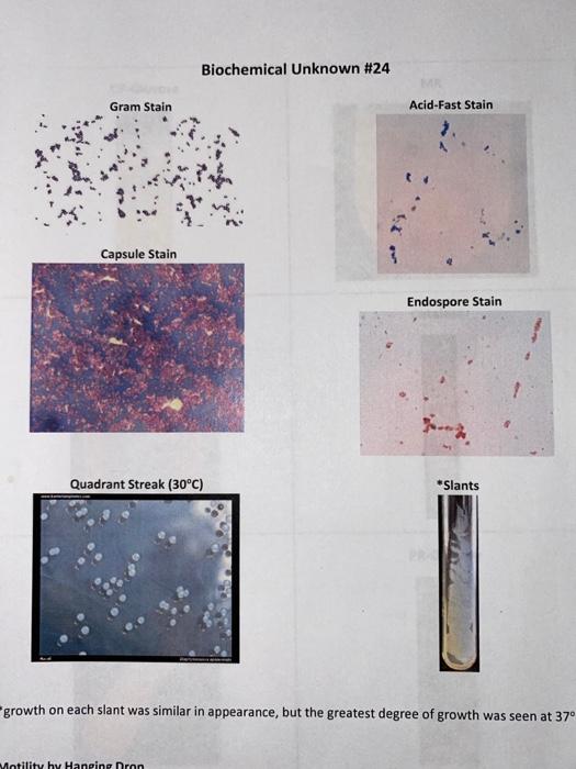 Solved Biochemical Unknown #24 Acid-Fast Stain Gram Stain | Chegg.com