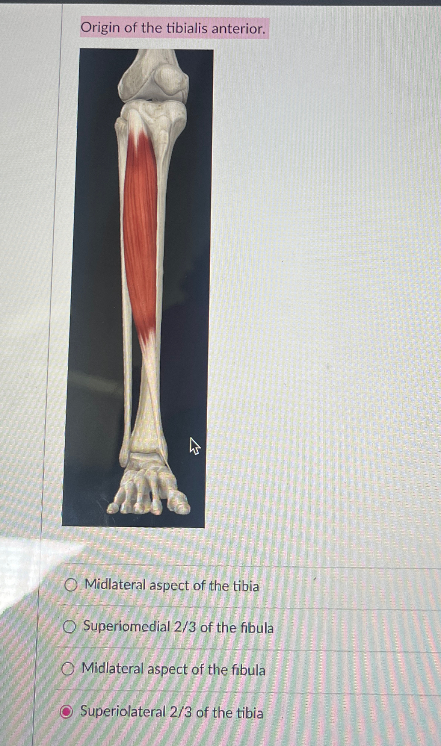 Solved Origin of the tibialis anterior.Midlateral aspect of | Chegg.com