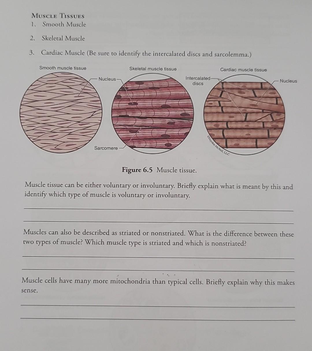 solved-muscle-tissues-1-smooth-muscle-2-skeletal-muscle-3-chegg