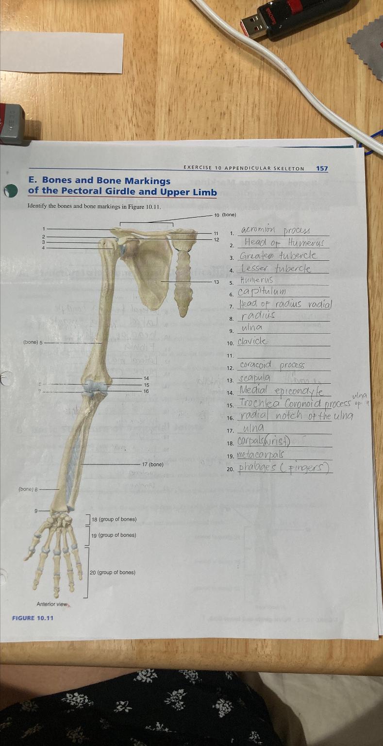 Solved EXERCISE 10 ﻿APPENDICULAR SKELETON 157E. ﻿Bones and