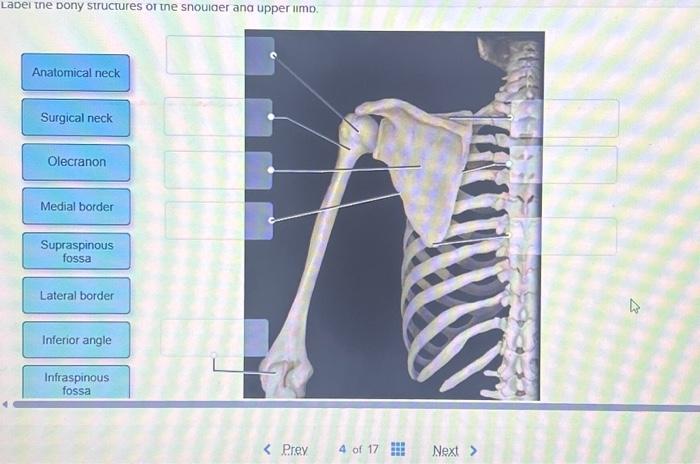 Solved Label the bony structures of the shoulder and upper | Chegg.com