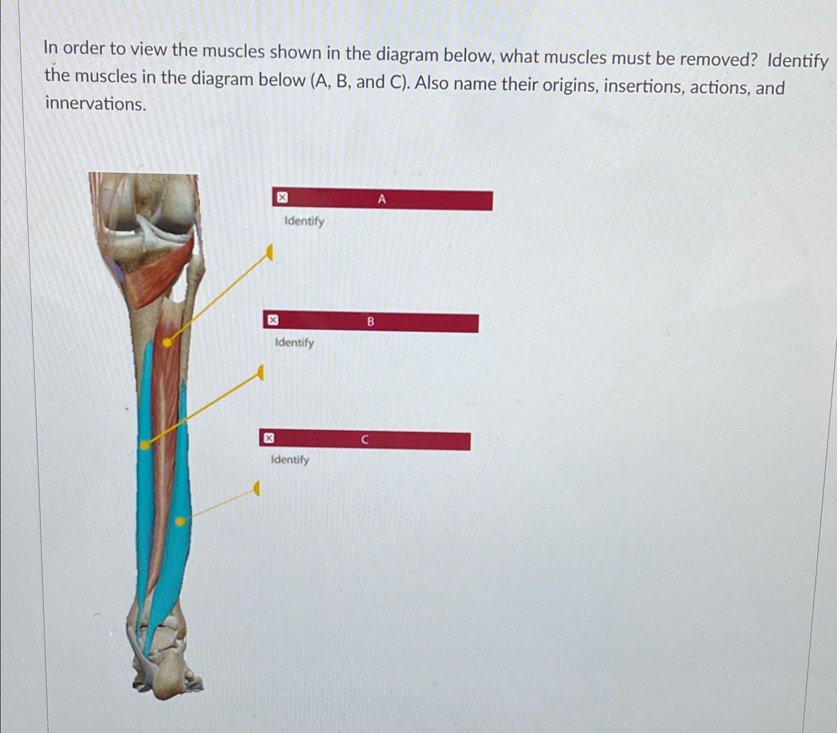 Solved In order to view the muscles shown in the diagram | Chegg.com