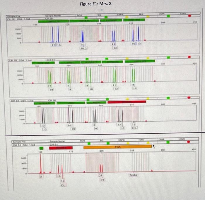 Below are four electropherograms, Figures E1-E4, | Chegg.com