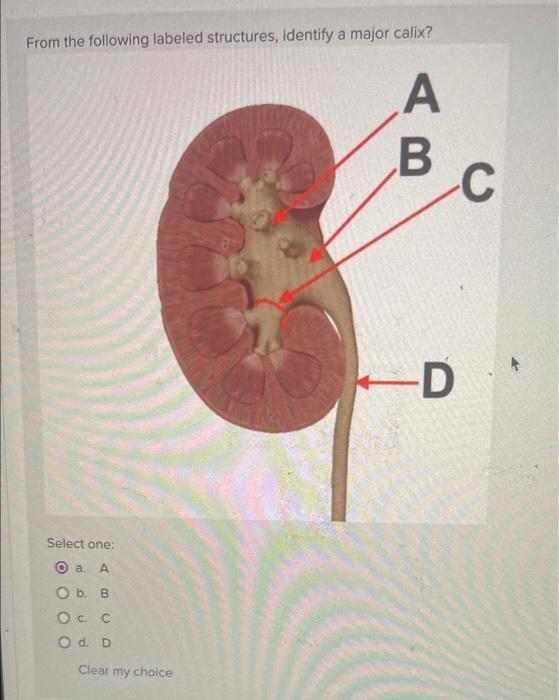 Solved From The Following Labeled Structures, Identify A | Chegg.com