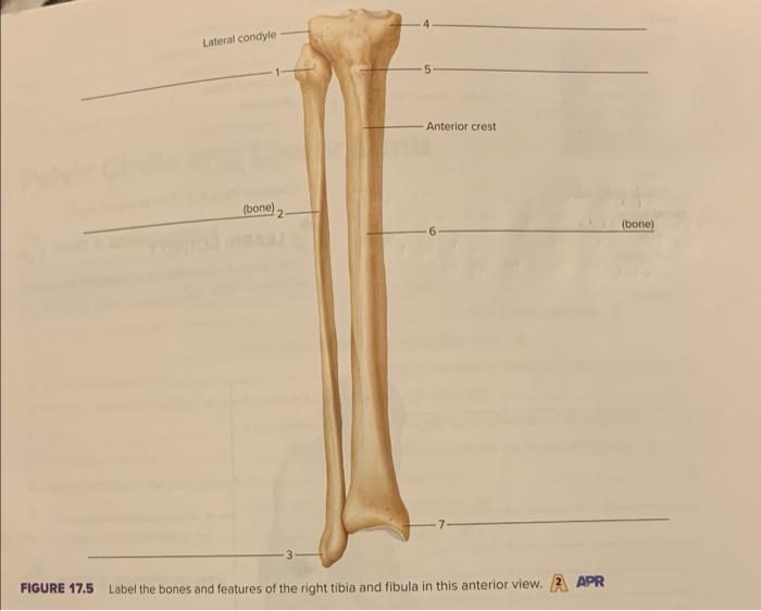 tibia anterior crest