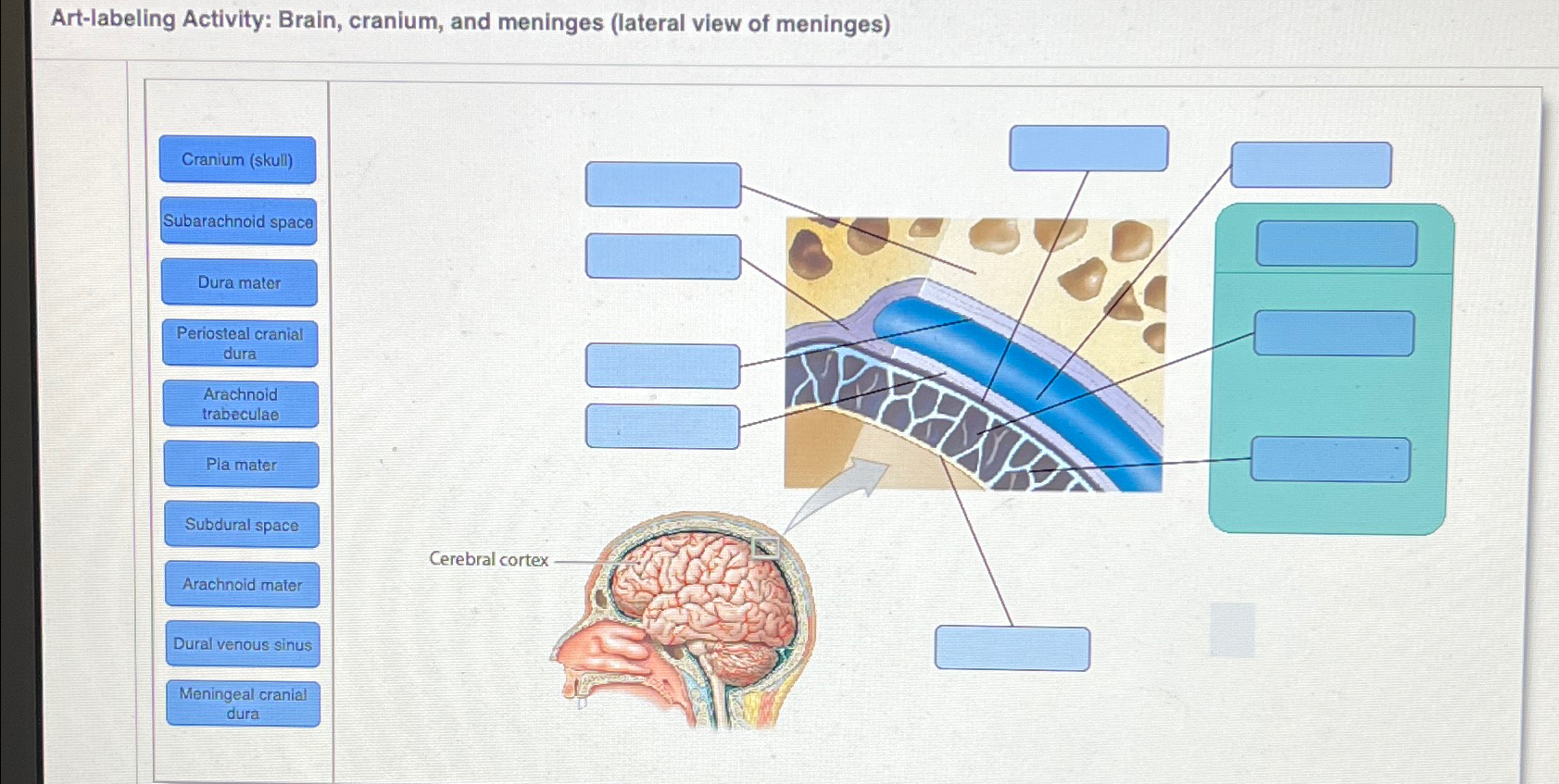 Solved Artlabeling Activity Brain, cranium, and meninges