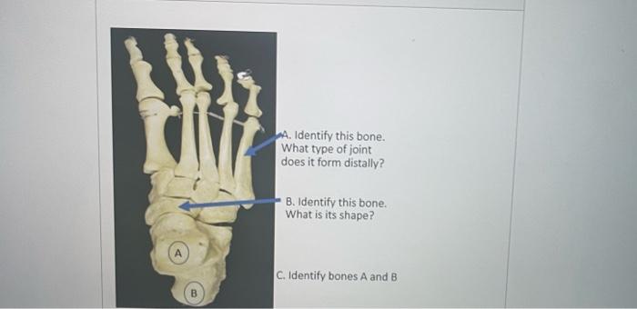 Solved A. Identify this joint What is the structural | Chegg.com