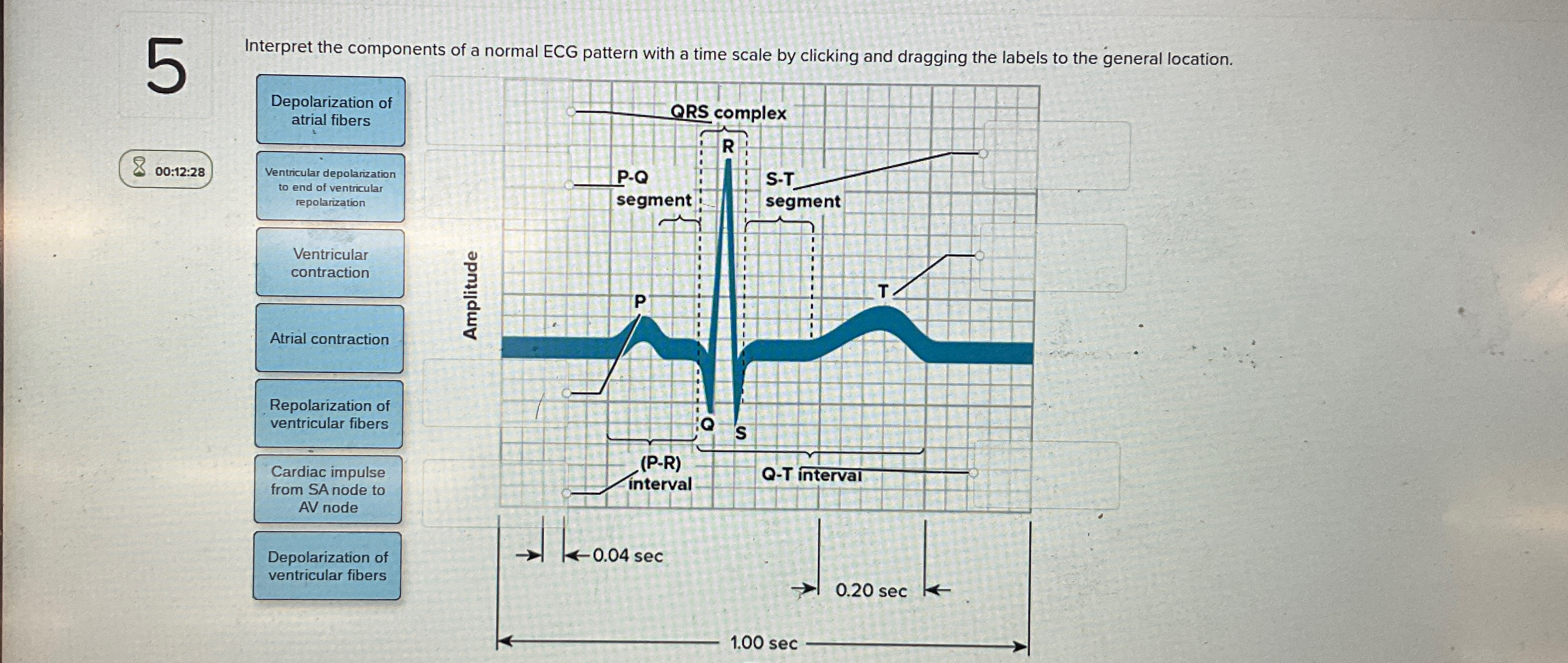 Solved Interpret the components of a normal ECG pattern with | Chegg.com