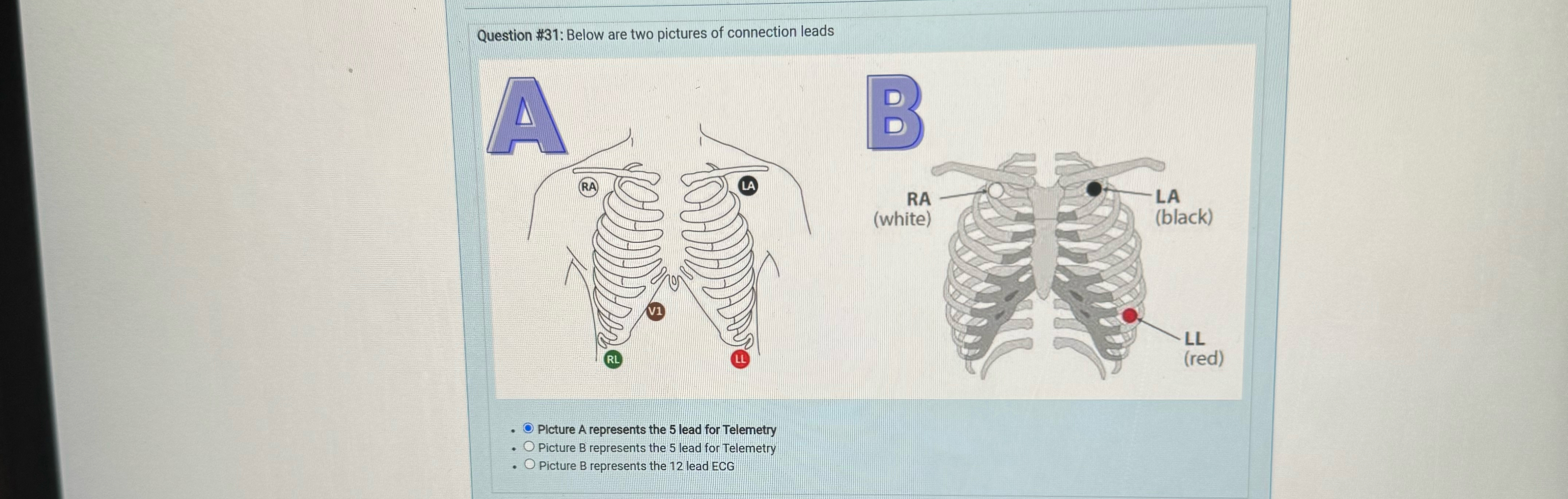 Question #31: Below are two pictures of connection | Chegg.com