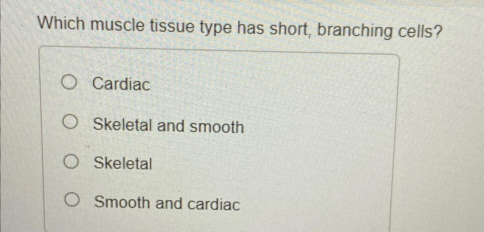 Solved Which muscle tissue type has short, branching | Chegg.com
