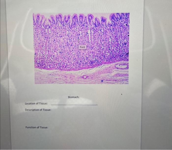 Solved Stomach: Location Of Tissue: Description Of Tissue: 