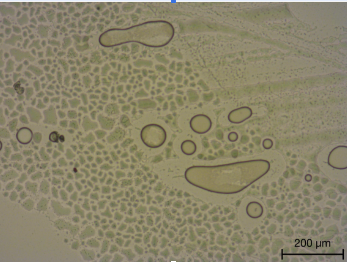 Solved What organelle is missing from E. ﻿coli?