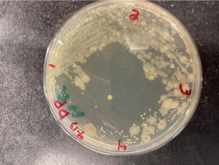 Colony descriptions: Isolate 1 E.Coli Isolate 2 | Chegg.com