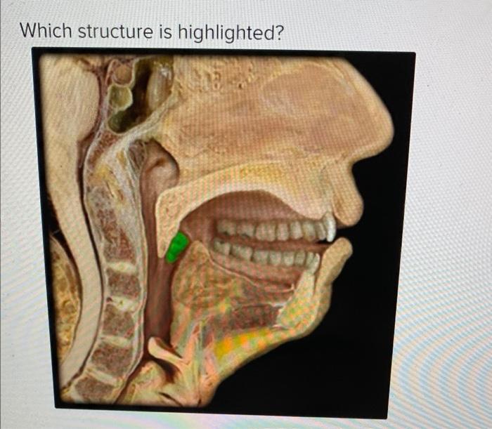 Solved Which structure is highlighted? Multiple Choice O | Chegg.com