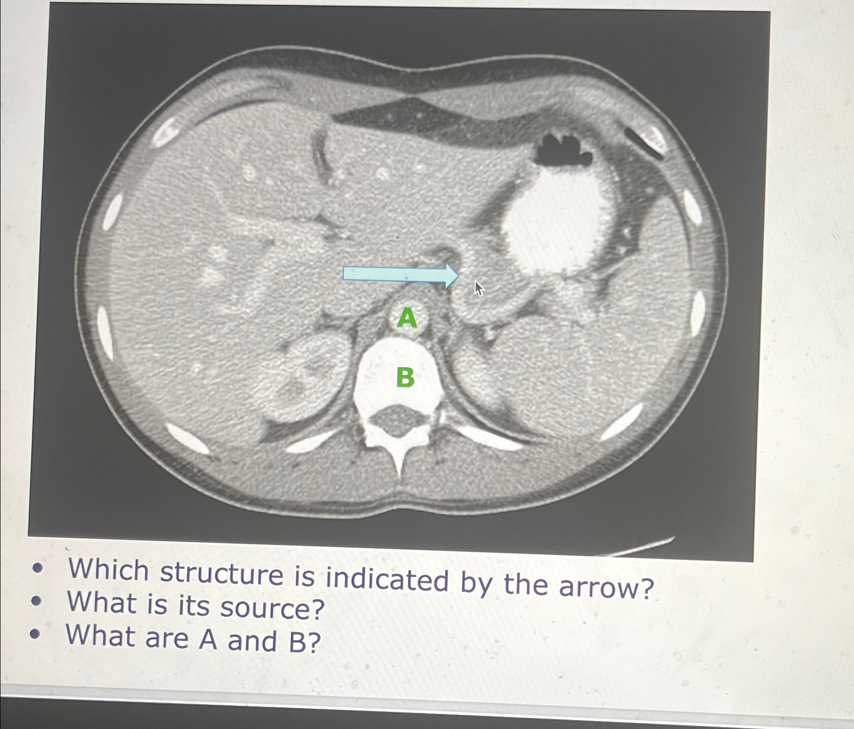 Solved Which structure is indicated by the arrow?What is its | Chegg.com