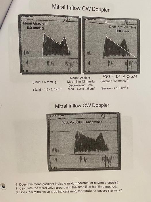 Solved Mitral Inflow CW Doppler Mitral Inflow CW Doppler 6.